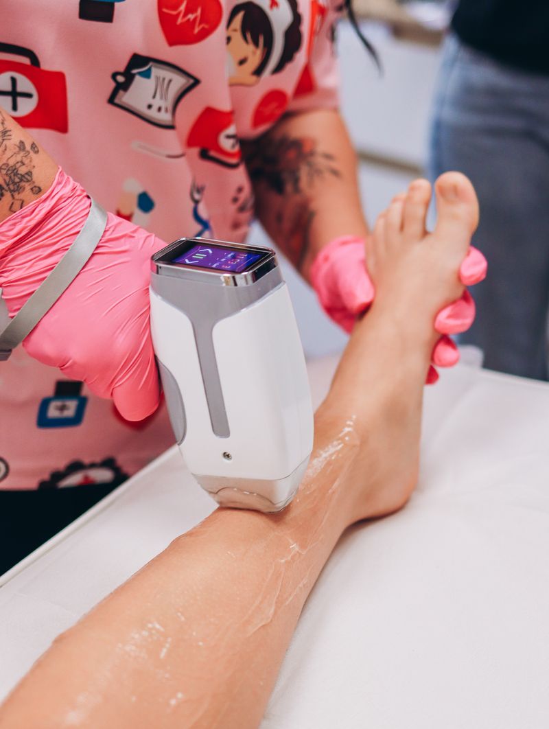 Skleroterapia laserowa Nd:YAG
