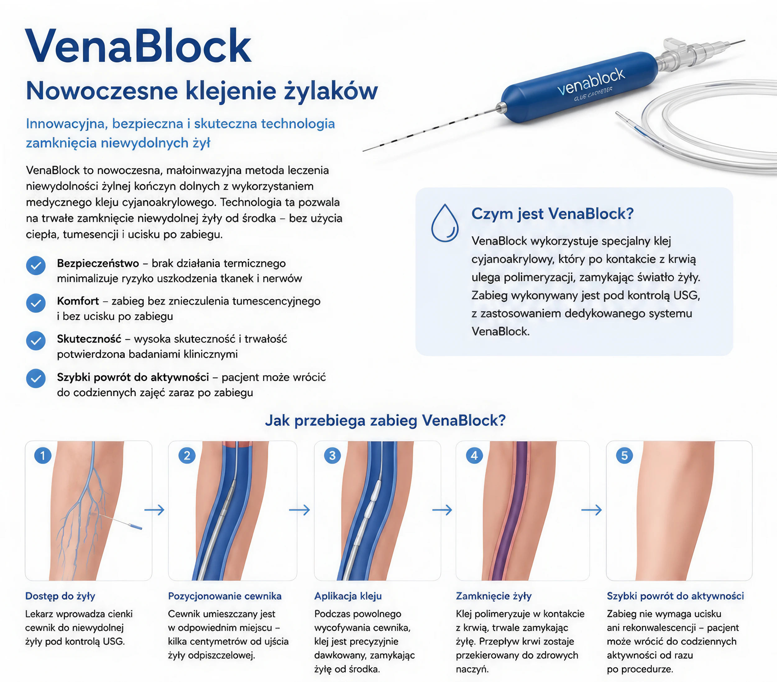 System VenaBlock® podczas zabiegu klejenia żylaków