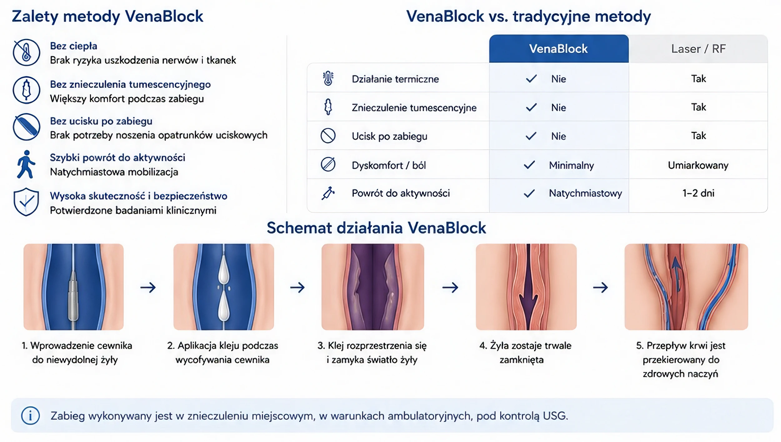 VenaBlock® – zabieg klejenia żylaków pod kontrolą USG
