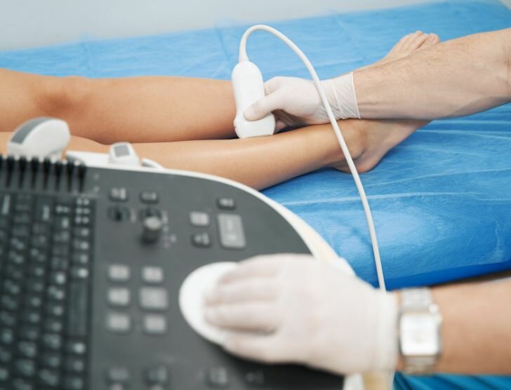 co-to-jest-badanie-usg-doppler.a8f07d91